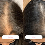 revive 4-in-1 hair growth device